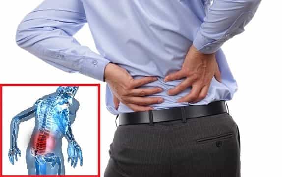 Đau lưng là bệnh phổ biến