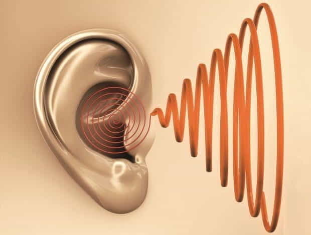 Ù tai là hiện tượng nghe âm thanh lạ trong tai